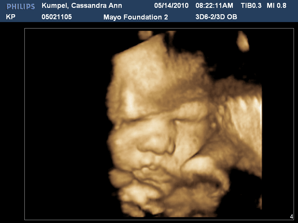 Baby’s nose at 20 weeks